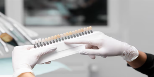 porcelain veneers