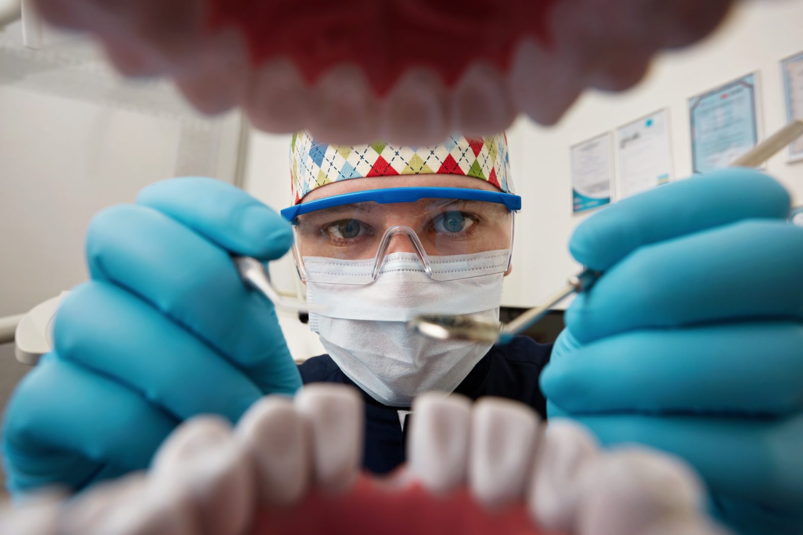 dental crowns